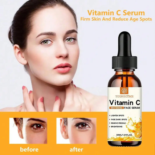 Dark Spot Correcting Vitamin C Essence – Moisturizing & Anti-Aging (30ml)