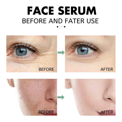 Pore-Shrinking Salicylic Acid Serum – Clarify, Hydrate & Anti-Aging
