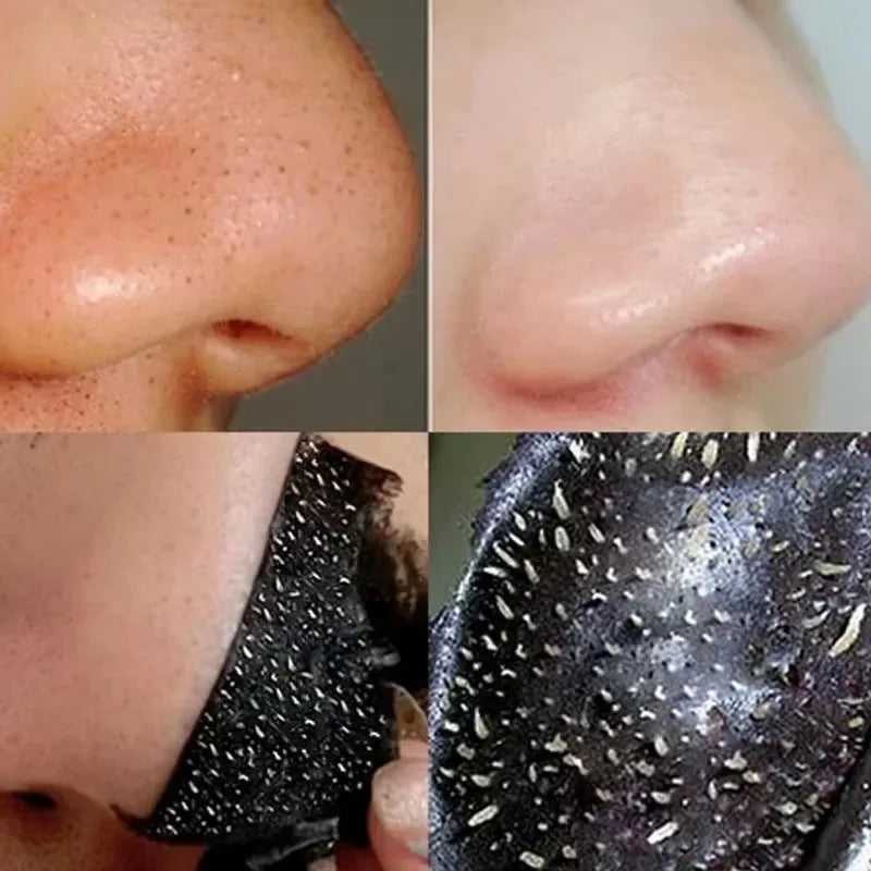 Blackhead & Acne Removal Mask – Bamboo Charcoal Nose & Face Cleanser