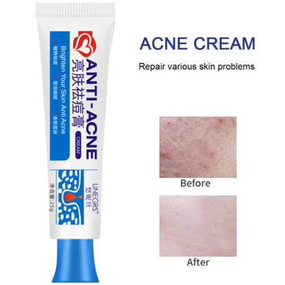 Pimple Scar Removal Herbal Gel – Anti-Acne & Skin Lightening