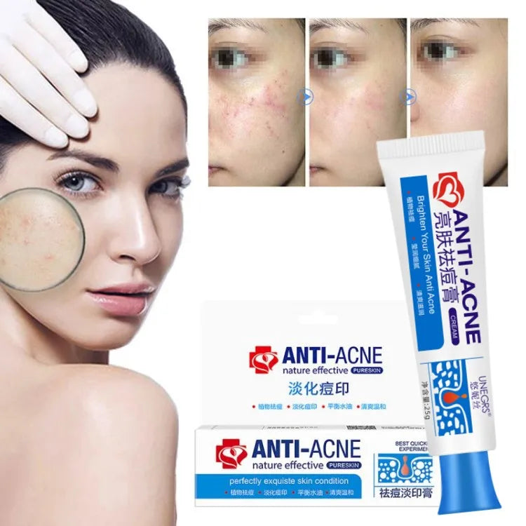 Pimple Scar Removal Herbal Gel – Anti-Acne & Skin Lightening